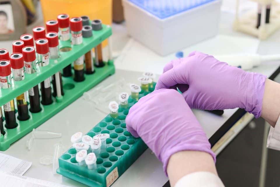 3 analize care detectează inflamația în organism