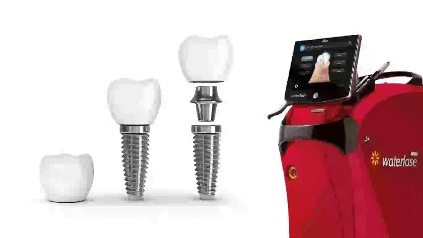 Franciza Life Dental Spa – obține și tu o afacere la cheie