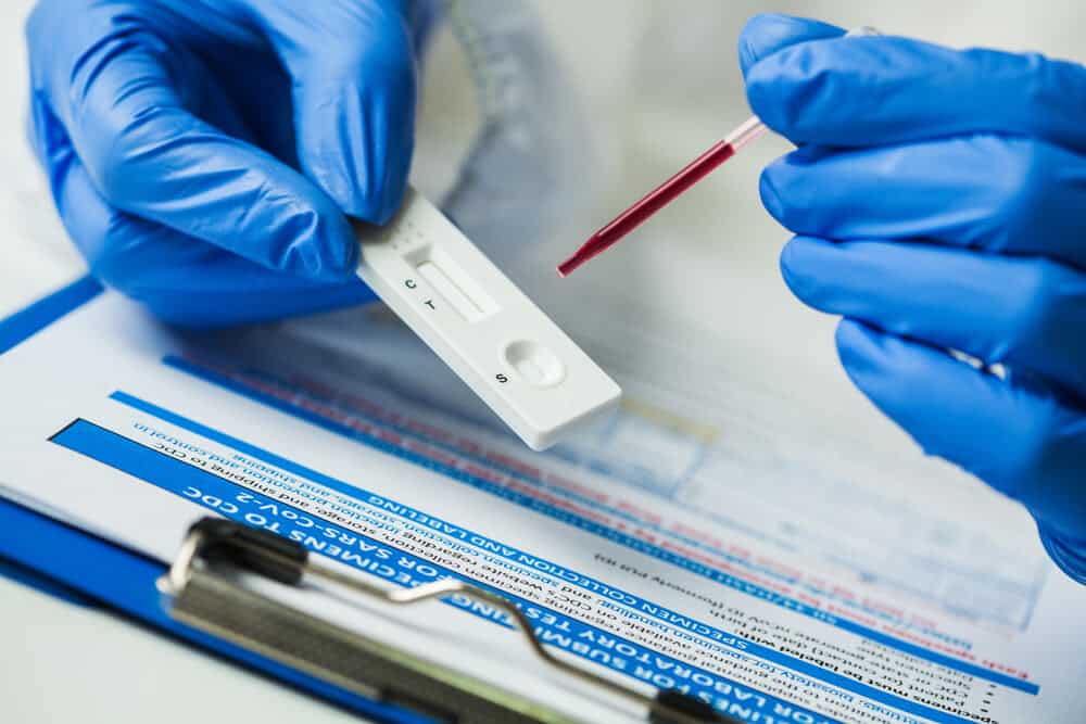 Revenirea la normalitate: Află ce test COVID-19 ți se potrivește