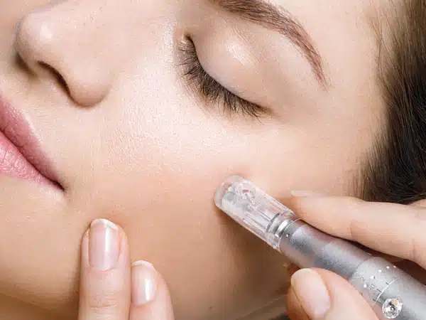 Procedura cu Microneedling e extrem de periculoasă. Tot mai multe femei apelează la ea