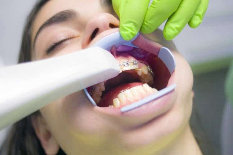 Din 2026, la Dentist Fără Bani prin CNAS. Ce Tratamente Sunt Acoperite Gratuit