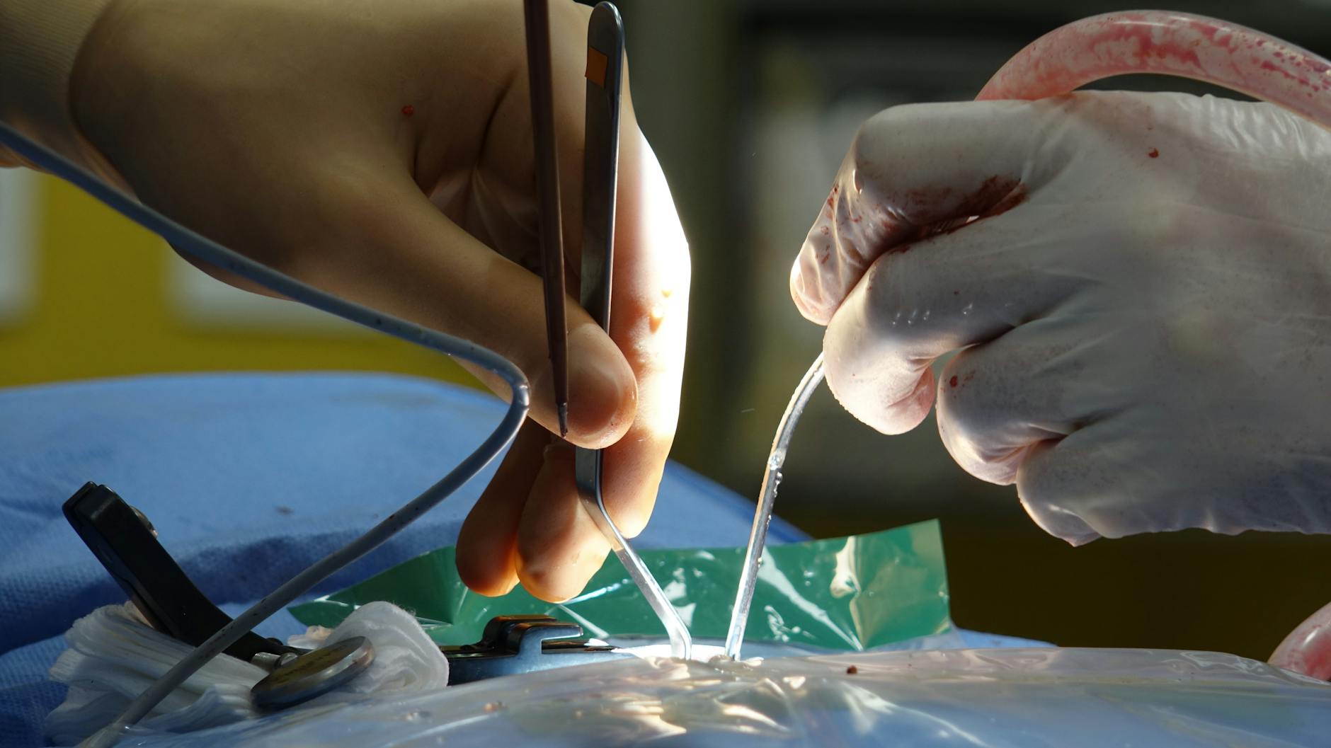 Peste 150 de operații pe an: Un neurochirurg român, acreditat ca Master Surgeon