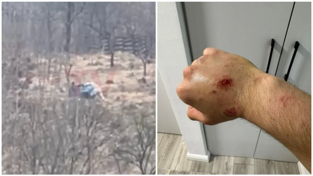 Polițist mușcat la Sighet în timpul unei capturi de țigări de 100.000 de euro