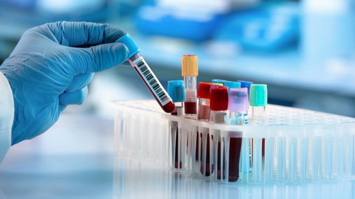Testul de sânge care depistează cancerul cerebral cu o acuratețe de peste 90%
