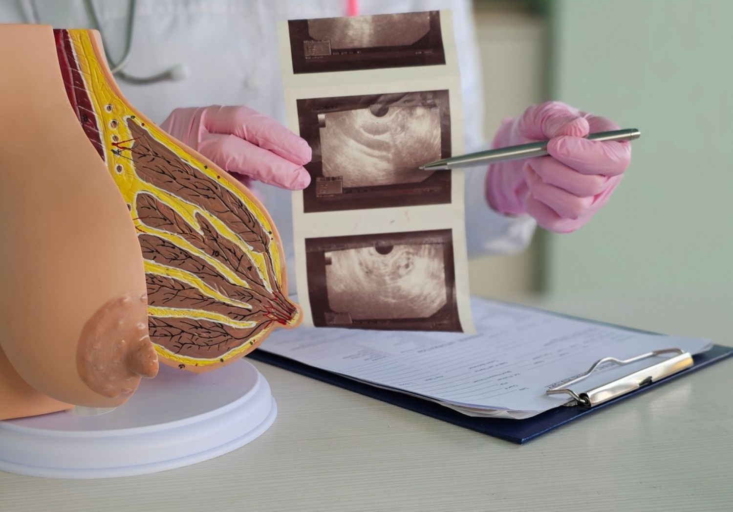 Ecografie mamară de screening anual: mituri și realități explicate