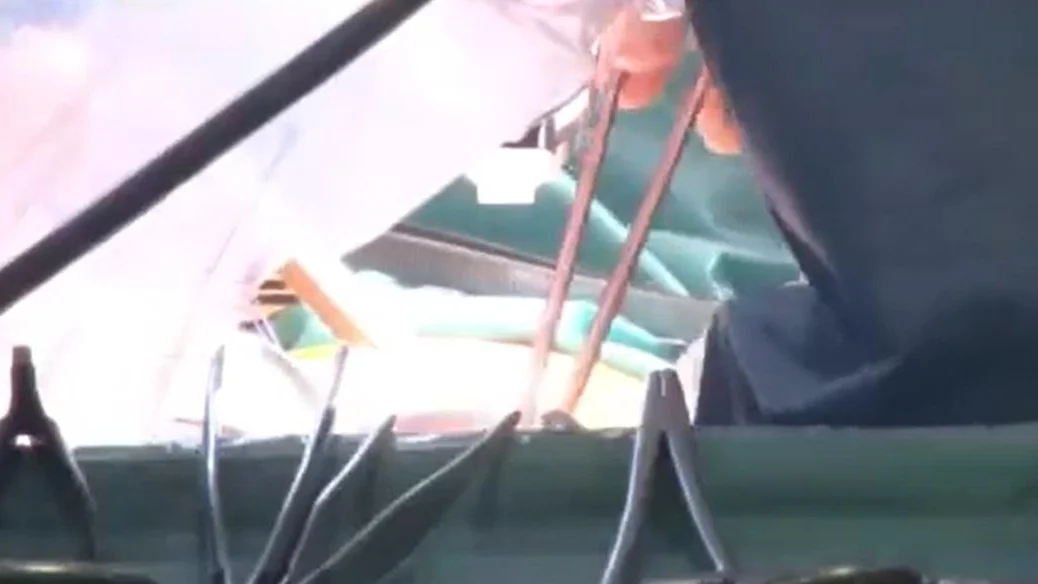 O operatie estetica banala a lasat o femeie in moarte cerebrala. Reactia medicului este uluitoare